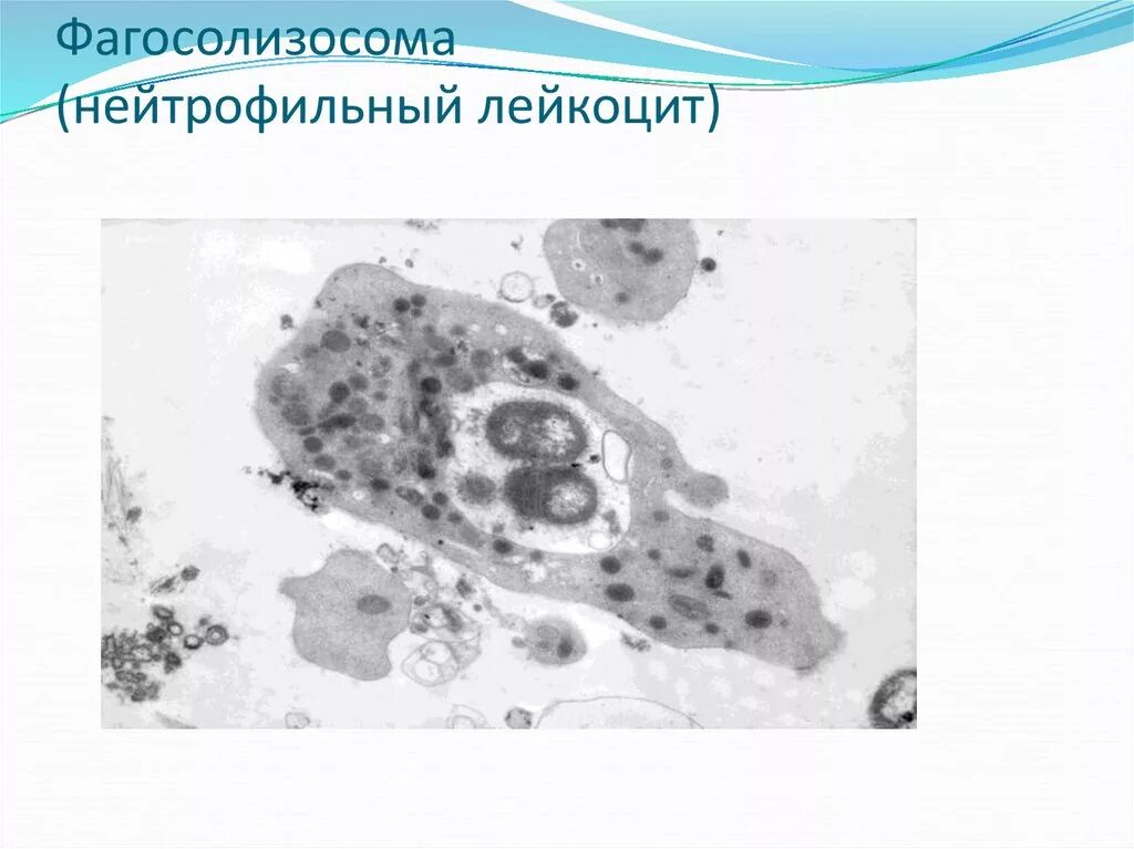 Воспаление фагоцитоз лейкоцит безразличный раздражитель микроворсинка. Фагоцитоз микроскопия. Фагоцитоз в эндотелиальных клетках электронная микроскопия. Фагоцитоз грибов или паразитов нейтрофилами. Фагоцитоз в мазке на флору.