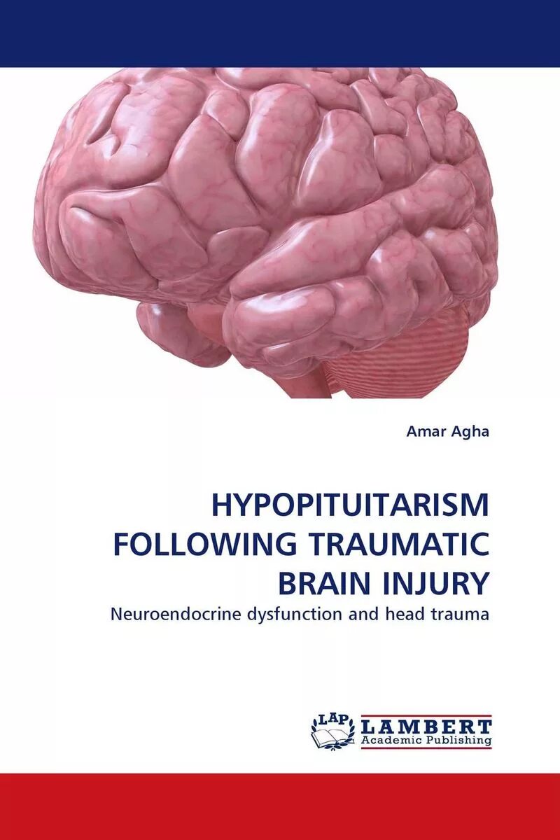 Traumatic brain. Гипопитуитаризм. Гипопитуитаризм картинки. Врожденный гипопитуитаризм. Гипопитуитаризм у взрослых.