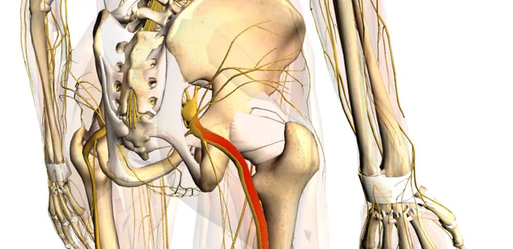 Седалищный в пояснице. Люмбаго ишиалгия. Люмбоишиалгия седалищного нерва. Защемление седалищного нерва анатомия. Седалищный нерв (sciatic nerve)? 011.