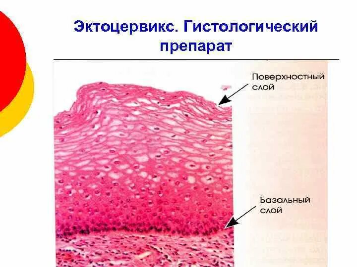 Nilm эндоцервикс. Nilm эндоцервикс