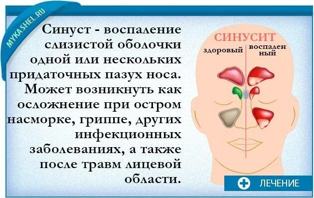 Кашель с мокротой насморк и температура. Зелёные сопли у взрослого без температуры признак. Кашель гайморит без температуры.