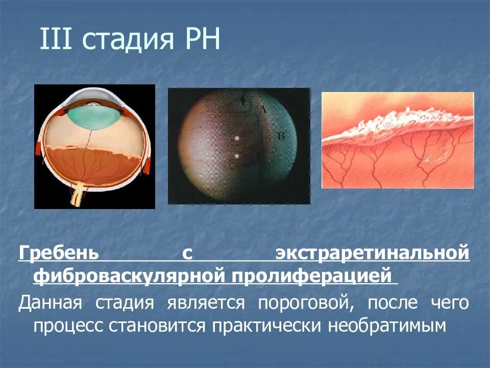 Iii стадия
