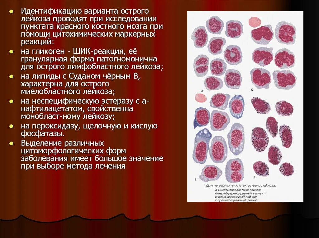 Мозг при остром лейкозе. Острый миелобластный лейкоз картина костного мозга. Острый миелобластный лейкоз характеризуется. Острый лейкоз костный мозг. Лимфобластный лейкоз костный мозг.