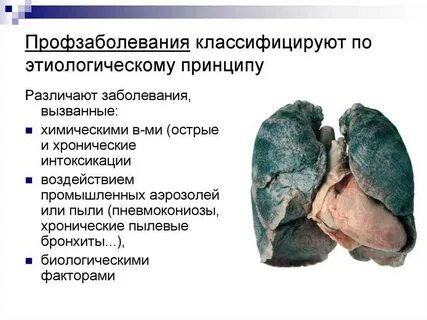 Дайте определение понятию профессиональное заболевание