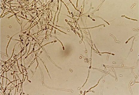 Candida spp у мужчин