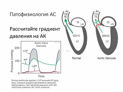 Градиент давления