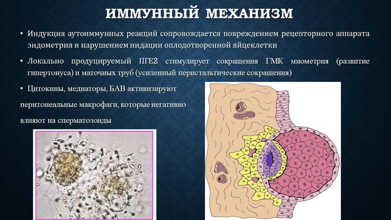 Эндометриоз презентация. Эндометриоз механизм развития. Эндометриоза презента. Эндометриоз аутоиммунное заболевание. Иммунное бесплодие