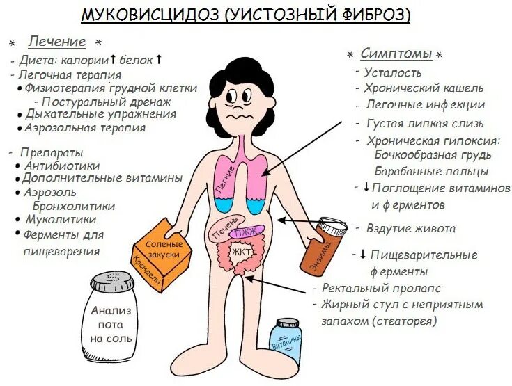 Как лечить муковисцидоз у взрослых. Симптомы муковисцидоза. муковисцидоз легочная форма. муковисцидозом симптомы.