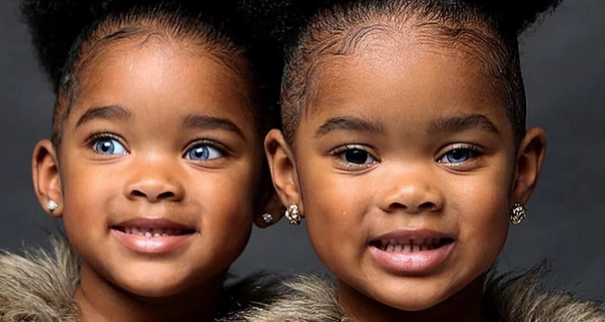 Метисы раса. Разрез глаз у разных рас. Нейтральное лицо. Люди со светлыми глазами. Разрез глаз расы.