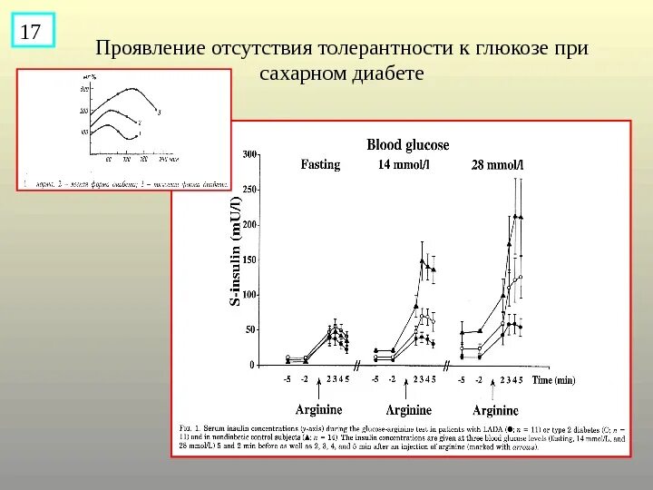 Глюкоза тест зачем. Кривая толерантности к глюкозе. Тест на толерантность к глюкозе сахарная кривая. При толерантности к глюкозе. Тест толерантности к глюкозе при сахарном диабете.