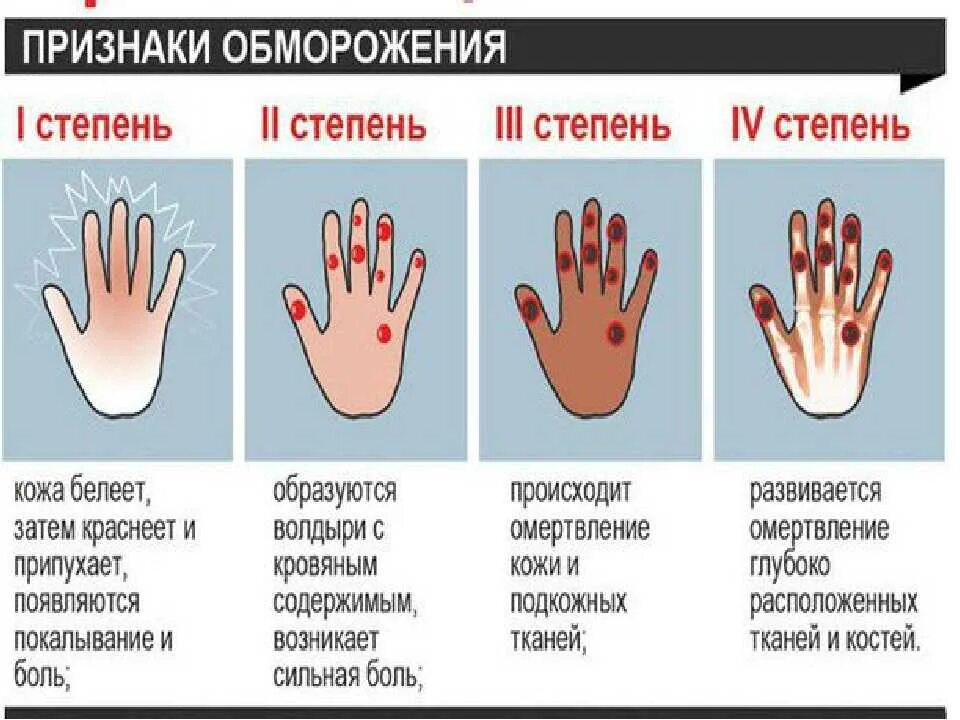 Ожоги отморожения оказание первой помощи. Отморожение третьей степени характеризуется следующими признаками:. Степени ожогов признаки и первая помощь.