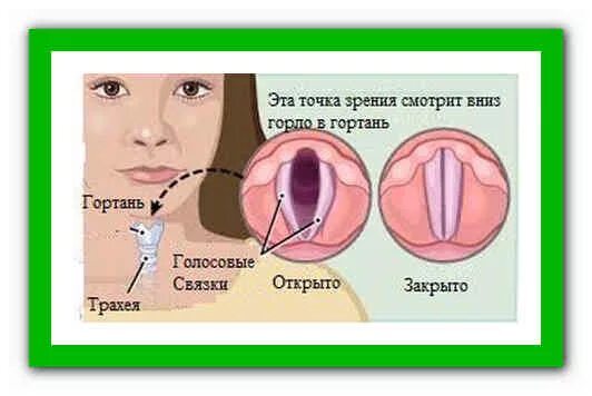 Хриплые голосовые связки. Лекарство чтобы восстановить голосовые связки. Препараты для голосовых связок. Препараты для восстановления голосовых связок. Восстановление голосовых связок.