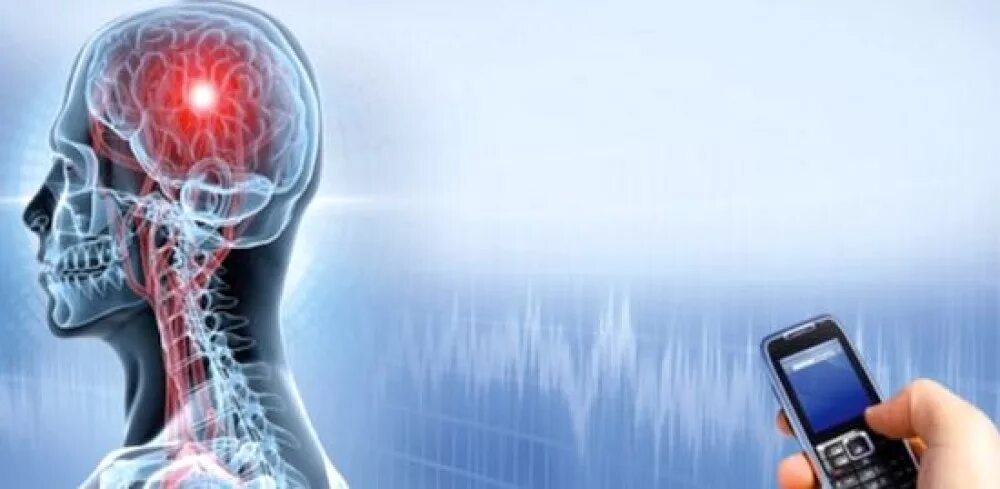 Влияние электромагнитного поля на человека. Электромагнитное излучение телефона. Электромагнитное излучение. Электромагнитные излучения мозга. Электромагнитные волны мобильного телефона.