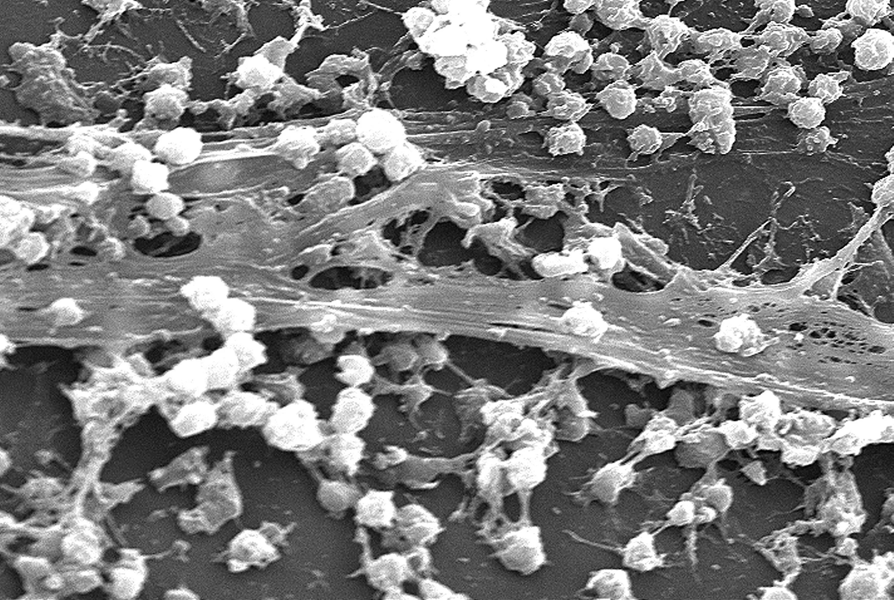 Разрушающие микроорганизмы. Staphylococcus epidermidis биопленки. Биопленка золотистого стафилококка. Биопленка Candida albicans. Pseudomonas биопленка.