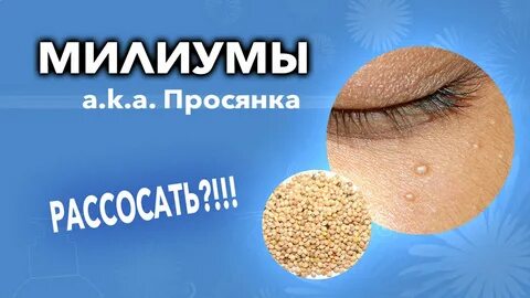 Где найти песчаного жировика