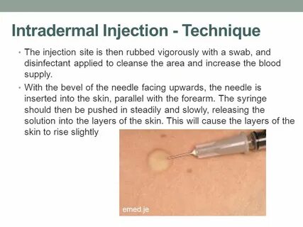Glow injection