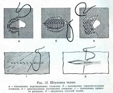 Как зашить чтобы не было шва