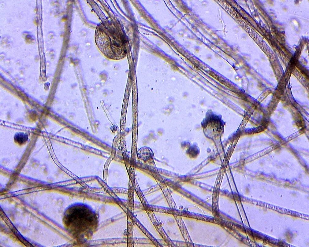 Плесневелые грибы микроскопия mucor. Плесень мукор. Мукор расемосус. Гриб mucor racemosus. Mucor racemosus.