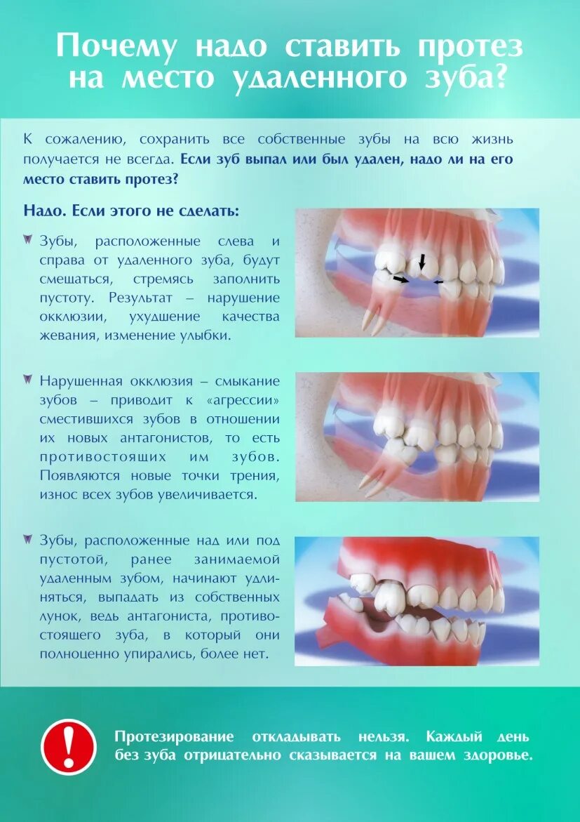 Через сколько можно ставить зуб после удаления