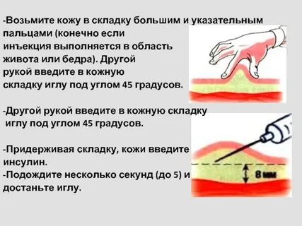 Уколоть палец