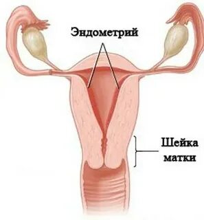 Гиперплазия цервикального канала