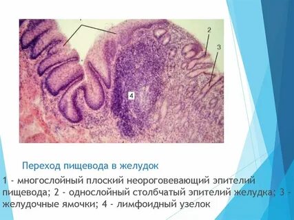 Какой эпителий выстилает желудок