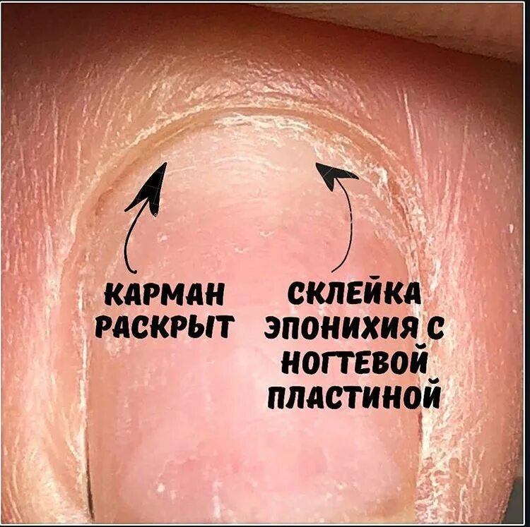 Как правильно снимать пластину Pin by Claudia on tecniche unghie Colorful nail designs, Nail courses, Nail tech