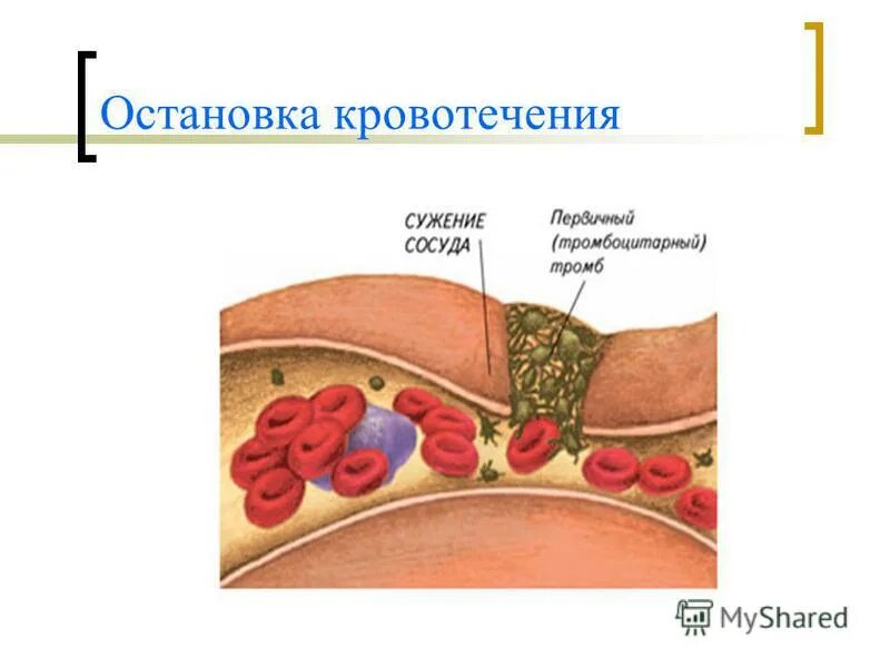 Почему плохая свертываемость крови