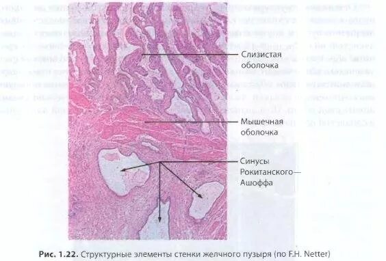 Слизистая оболочка желчного пузыря. Эпителий желчного пузыря гистология. Ходы Люшка желчного пузыря гистология. Строение желчного пузыря гистология. Желчный пузырь гистология препарат.