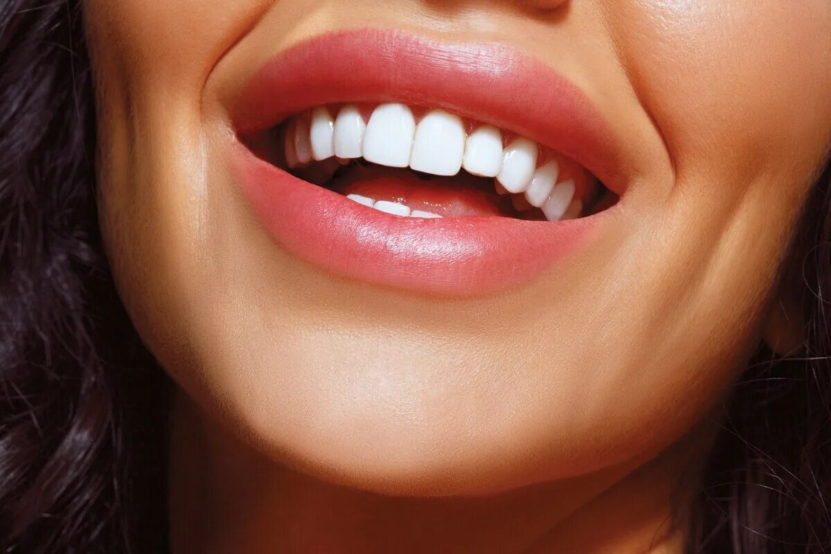 Улыбкой губы твои. Голливудская улыбка виниры. Красивые зубы. Красивые ровные зубы. Красивая улыбка.