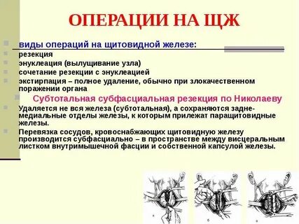 Какие операции делают на щитовидке