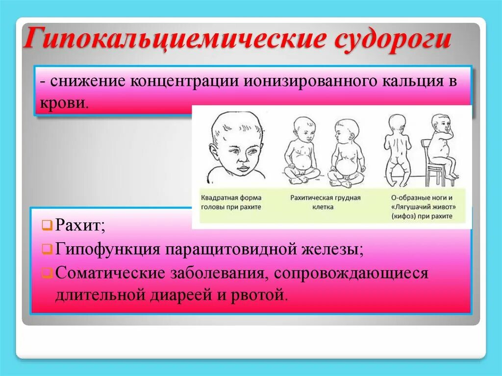 Припадки у детей. Гипокальциемические судороги. Гипокальциемические судороги возникают при. Гипогликемические судороги у детей.