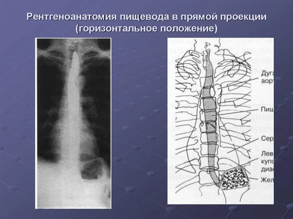 Лучевая пищевода. Рентгеновская анатомия пищевода. Сегменты пищевода рентгенодиагностика. Рентгеноанатомия пищевода. Проекция пищевода.