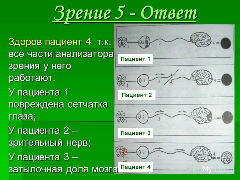 Видишь минус 5. Зрение -5. Зрение -5.5. Как выглядит зрение -6. Зрение -5 как видит.