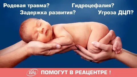 Дцп родовая травма