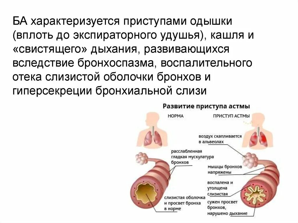 Мокрота и свисты. Бронхиальная астма. Приступ астмы. Бронхиальная астма характеризуется. Приступ удушья кашель.