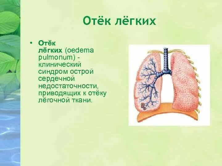 Отек легких презентация. Отек легких у взрослых причины