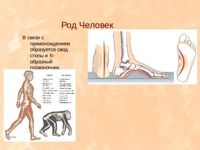 С прямохождением у человека появилась. Изменения в скелете человека в связи с прямохождением. У человека в связи с прямохождением стопа. Связи с прямо хождение у человека. Всвязи с прямохождением у человека.