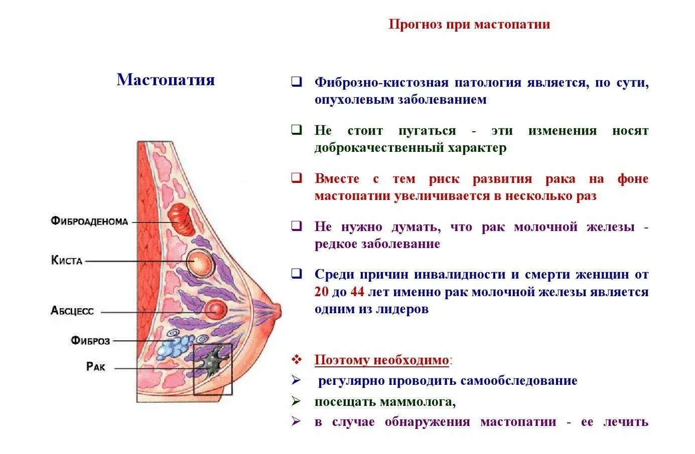 Лактостаз форум