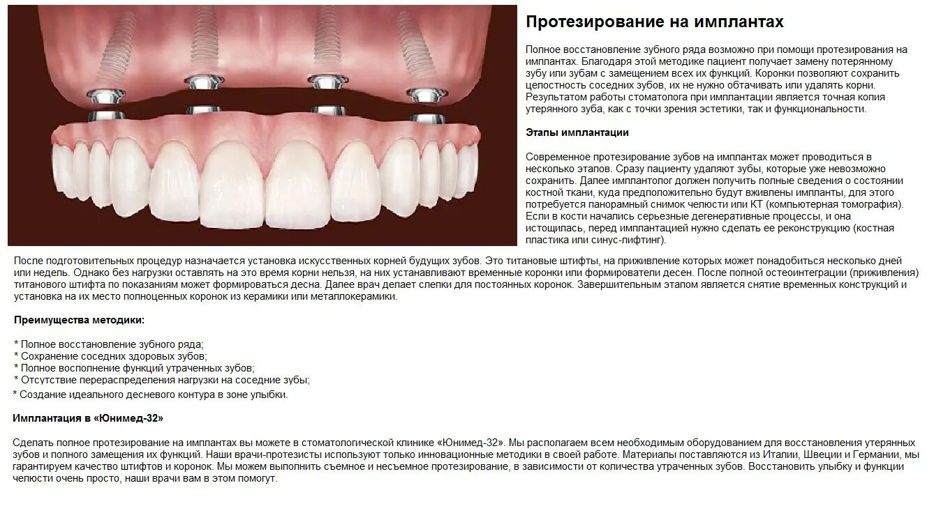 Через сколько можно вставить зубы. Клинические особенности протезирования на имплантатах.. Этапы имплантации зубов. Этапы постановки импланта зуба.