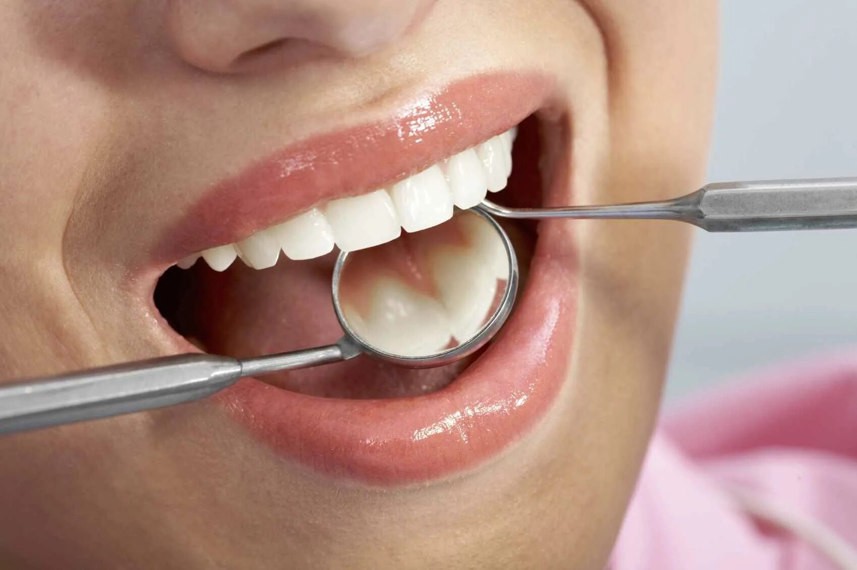 Профессиональная гигиена. Гигиена полости рта. Зубной. Чистка зубов после лечения