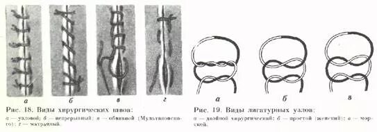 Как называется шов после операции. Хирургические швы и узлы. непрерывные узловые швы в хирургии. узловатый шов хирургия. хирургические швы ветеринария прерывистый.