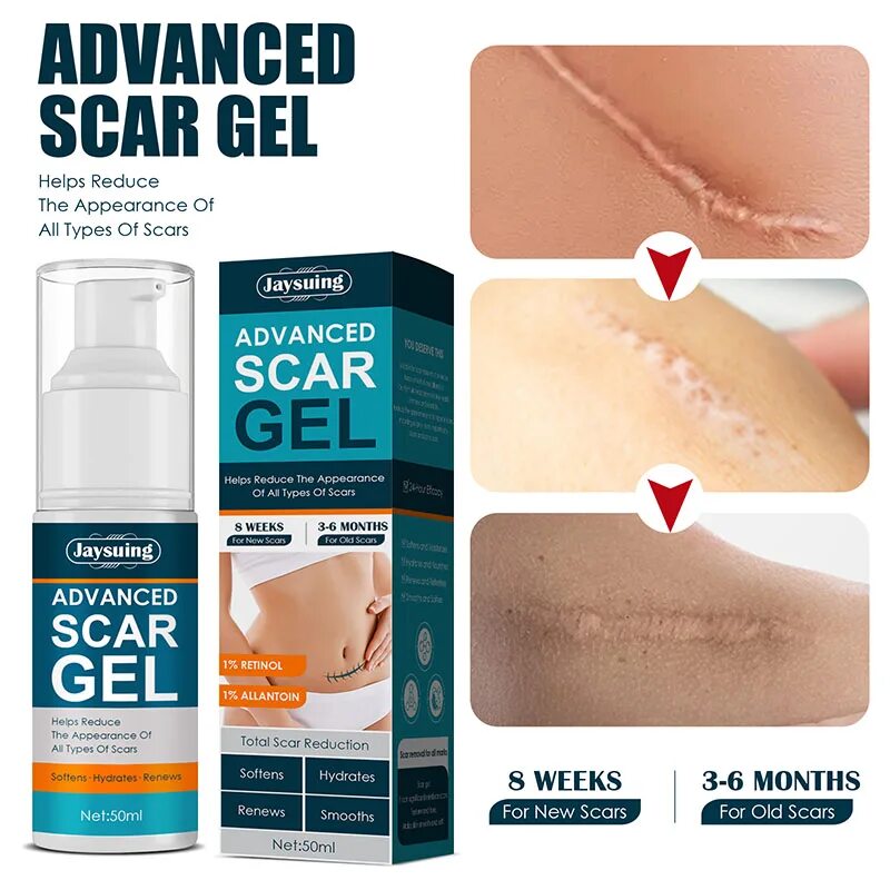 Scar Gel с АЛИЭКСПРЕСС. Scar Gel от рубцов и шрамов отзывы. Acne Plasters. Advanced gel
