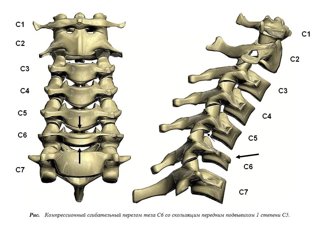 Шейный отдел позвоночника сбоку. 4 Шейный позвонок сбоку. 6 Шейный позвонок вид сбоку. Позвонки шейного отдела позвоночника человека.