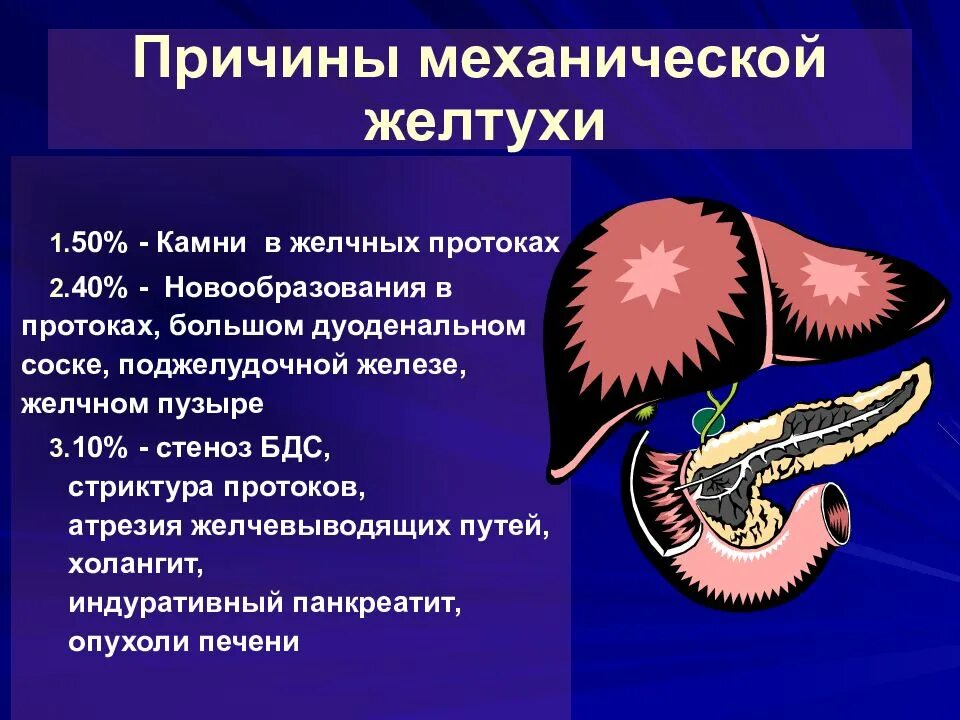 Желтуха код по мкб 10 у взрослых. Механическая желтуха. механическая желтуха симптомы. клинические проявления механической желтухи. механическая желтуха желчных проток.