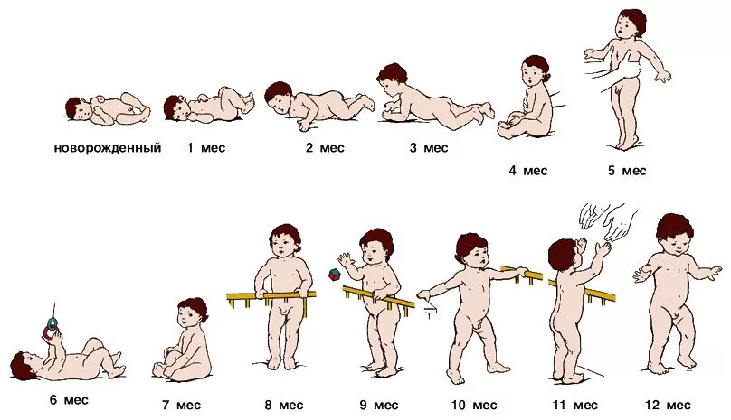 Симптомы ДЦП У грудничка в 4 месяца. Симптомы ДЦП У грудничка в 2 месяца. Признаки ДЦП У грудничка до года. Синдром двигательных расстройств у новорожденных. Дцп 3 месяца