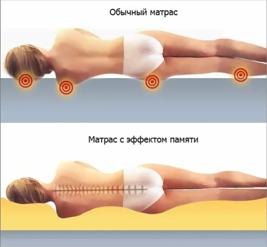 Поясница матрас. Правильное положение тела на матрасе. Ортопедический матрас позвоночник. Правильный матрас для спины. Ортопедический матрас с эффектом памяти.