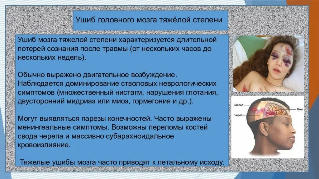 Что такое контузия словами и последствия. Ушиб головного мозга тяжелой степени. Контузия головного мозга тяжелой степени. Ушиб головного мозга характеризуется. Нистагм при ушибе головного мозга.