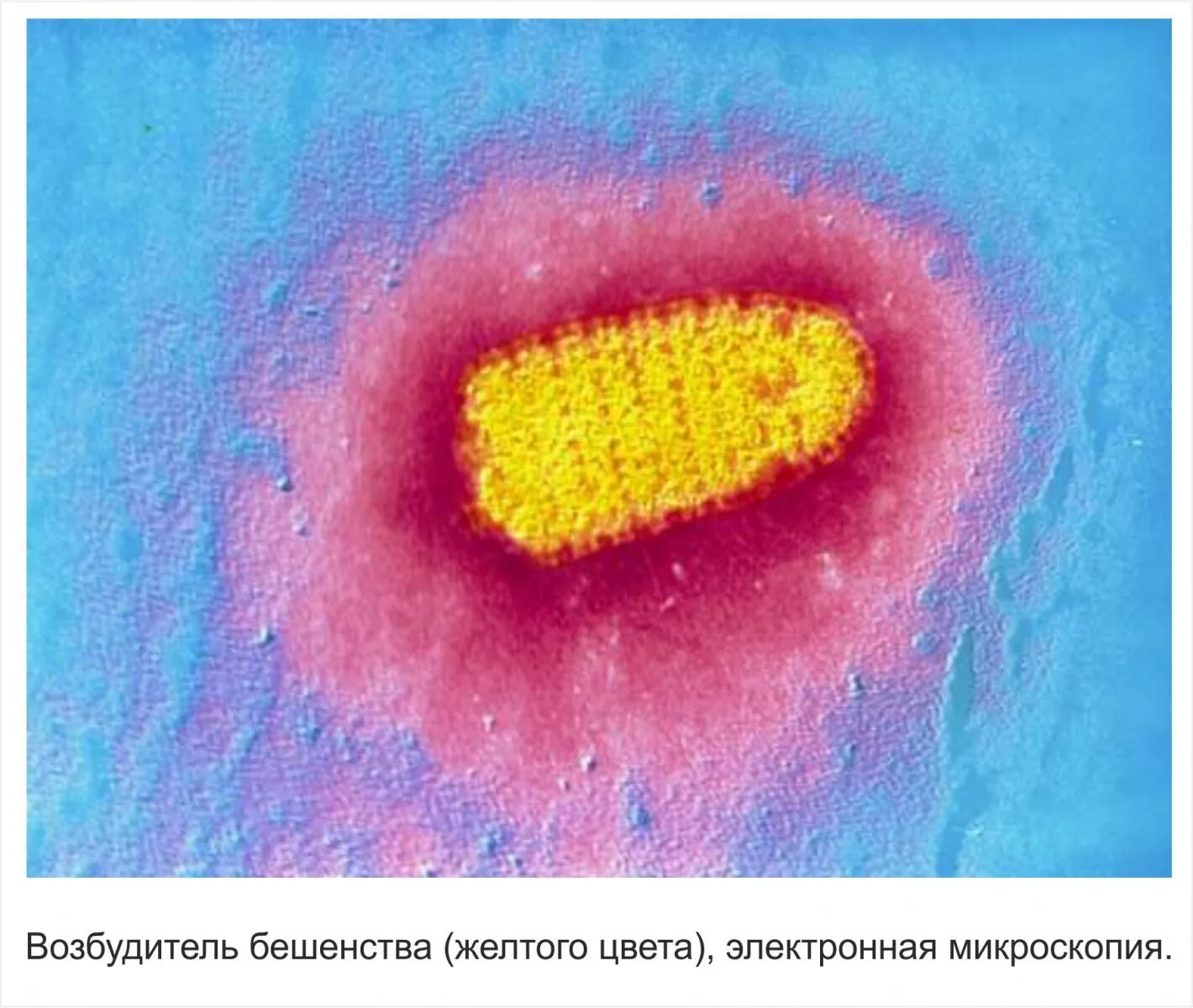 вирус вызывающий бешенство