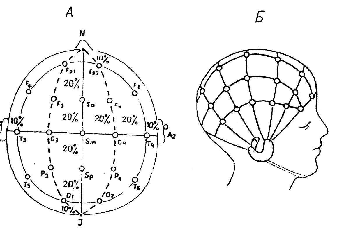 Ээг 10 10. Схема расположения электродов ЭЭГ. Схема ЭЭГ 10-20. Схема расположения электродов 10-20 ЭЭГ. Электроэнцефалография схема 10 20.